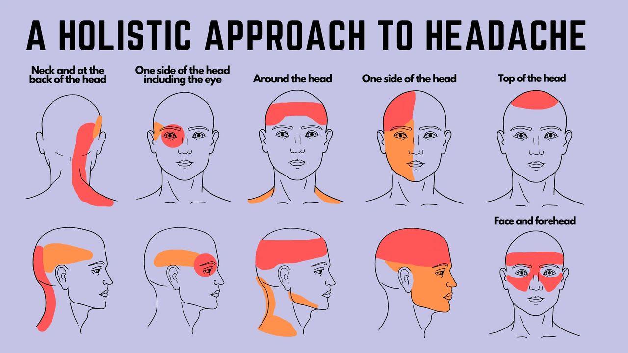Headache Chart Types By Symptoms Location And Causes 41 OFF